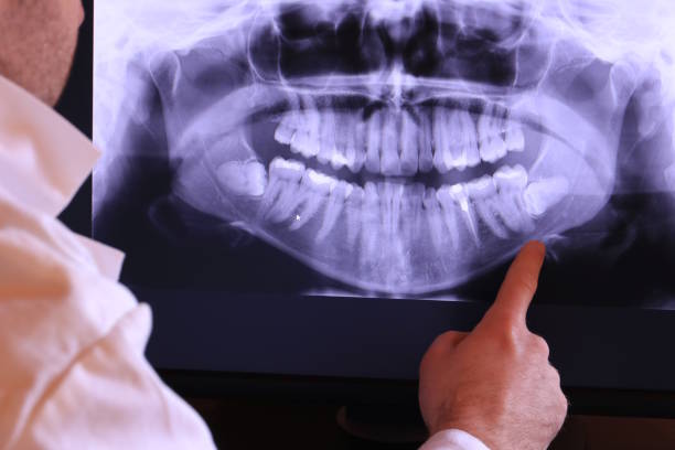 Best Emergency Tooth Extraction in Baltimore, MD