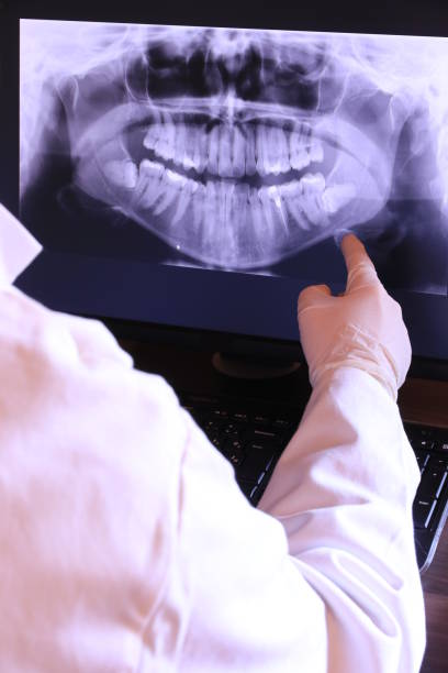 Best Emergency Dental Care for Broken or Chipped Teeth in Baltimore, MD